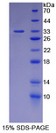 CA12 / Carbonic Anhydrase XII Protein - Recombinant Carbonic Anhydrase XII By SDS-PAGE