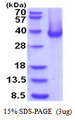 CA12 / Carbonic Anhydrase XII Protein