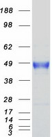 CA12 / Carbonic Anhydrase XII Protein - Purified recombinant protein CA12 was analyzed by SDS-PAGE gel and Coomassie Blue Staining