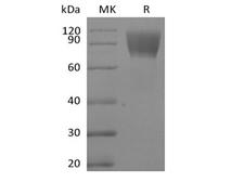 CA125 Protein - Recombinant Human CA125/MUC16 (C-Fc-Avi) Biotinylated
