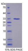 CA13 / Carbonic Anhydrase XIII Protein - Recombinant Carbonic Anhydrase XIII (CA13) by SDS-PAGE