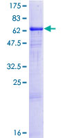 CA14 / Carbonic Anhydrase XIV Protein - 12.5% SDS-PAGE of human CA14 stained with Coomassie Blue