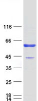 CA14 / Carbonic Anhydrase XIV Protein - Purified recombinant protein CA14 was analyzed by SDS-PAGE gel and Coomassie Blue Staining