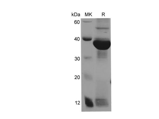 CA199 Gastrointestinal Cancer Antigen Protein - Recombinant Human CA199(FUT3) Protein (His Tag)
