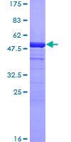 CA2 / Carbonic Anhydrase II Protein - 12.5% SDS-PAGE of human CA2 stained with Coomassie Blue
