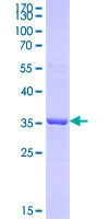CA2 / Carbonic Anhydrase II Protein - 12.5% SDS-PAGE Stained with Coomassie Blue