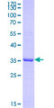 CA2 / Carbonic Anhydrase II Protein - 12.5% SDS-PAGE Stained with Coomassie Blue