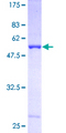 CA3 / Carbonic Anhydrase III Protein - 12.5% SDS-PAGE of human CA3 stained with Coomassie Blue