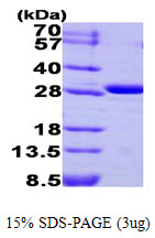 CA3 / Carbonic Anhydrase III Protein