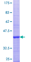CA4 / Carbonic Anhydrase IV Protein - 12.5% SDS-PAGE Stained with Coomassie Blue.