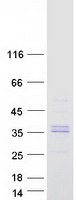 CA5A / Carbonic Anhydrase VA Protein - Purified recombinant protein CA5A was analyzed by SDS-PAGE gel and Coomassie Blue Staining