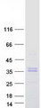 CA5A / Carbonic Anhydrase VA Protein - Purified recombinant protein CA5A was analyzed by SDS-PAGE gel and Coomassie Blue Staining