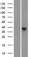CA6 / Carbonic Anhydrase 6 Protein - Western validation with an anti-DDK antibody * L: Control HEK293 lysate R: Over-expression lysate
