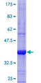 CA6 / Carbonic Anhydrase 6 Protein - 12.5% SDS-PAGE Stained with Coomassie Blue.