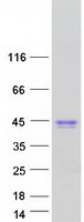 CA6 / Carbonic Anhydrase 6 Protein - Purified recombinant protein CA6 was analyzed by SDS-PAGE gel and Coomassie Blue Staining
