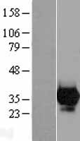 CA7 / Carbonic Anhydrase VII Protein - Western validation with an anti-DDK antibody * L: Control HEK293 lysate R: Over-expression lysate