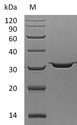 CA7 / Carbonic Anhydrase VII Protein - (Tris-Glycine gel) Discontinuous SDS-PAGE (reduced) with 5% enrichment gel and 15% separation gel.