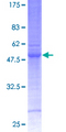 CA7 / Carbonic Anhydrase VII Protein - 12.5% SDS-PAGE of human CA7 stained with Coomassie Blue