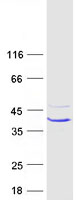 CA7 / Carbonic Anhydrase VII Protein - Purified recombinant protein CA7 was analyzed by SDS-PAGE gel and Coomassie Blue Staining