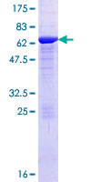 CA8 / Carbonic Anhydrase VIII Protein - 12.5% SDS-PAGE of human CA8 stained with Coomassie Blue