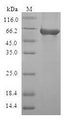 CA8 / Carbonic Anhydrase VIII Protein - (Tris-Glycine gel) Discontinuous SDS-PAGE (reduced) with 5% enrichment gel and 15% separation gel.