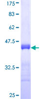 CA8 / Carbonic Anhydrase VIII Protein - 12.5% SDS-PAGE Stained with Coomassie Blue.