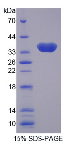 CA8 / Carbonic Anhydrase VIII Protein - Recombinant Carbonic Anhydrase VIII By SDS-PAGE