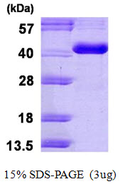 CA8 / Carbonic Anhydrase VIII Protein