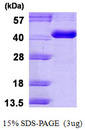 CA8 / Carbonic Anhydrase VIII Protein