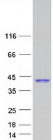 CA8 / Carbonic Anhydrase VIII Protein - Purified recombinant protein CA8 was analyzed by SDS-PAGE gel and Coomassie Blue Staining