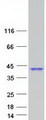 CA8 / Carbonic Anhydrase VIII Protein - Purified recombinant protein CA8 was analyzed by SDS-PAGE gel and Coomassie Blue Staining