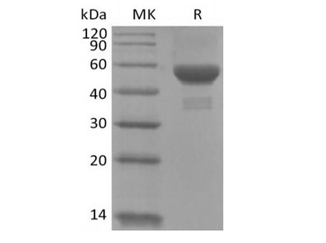 CA9 / Carbonic Anhydrase IX Protein - Recombinant Human Carbonic Anhydrase IX/CA9 (C-6His)