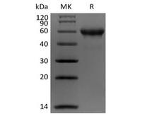 CA9 / Carbonic Anhydrase IX Protein - Recombinant Human Carbonic Anhydrase IX/CA9 (C-Avi-6His) Biotinylated
