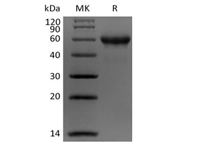CA9 / Carbonic Anhydrase IX Protein - Recombinant Human Carbonic Anhydrase IX/CA9 (C-Avi-6His) Biotinylated