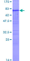 CA9 / Carbonic Anhydrase IX Protein - 12.5% SDS-PAGE of human CA9 stained with Coomassie Blue