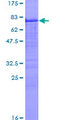 CA9 / Carbonic Anhydrase IX Protein - 12.5% SDS-PAGE of human CA9 stained with Coomassie Blue