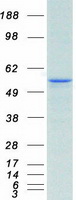 CA9 / Carbonic Anhydrase IX Protein - Purified recombinant protein CA9 was analyzed by SDS-PAGE gel and Coomassie Blue Staining