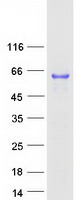 CAAP1 Protein - Purified recombinant protein CAAP1 was analyzed by SDS-PAGE gel and Coomassie Blue Staining