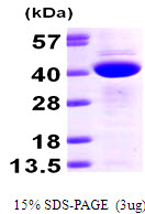 CAB39 / MO25 Protein