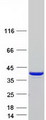 CAB39L Protein - Purified recombinant protein CAB39L was analyzed by SDS-PAGE gel and Coomassie Blue Staining
