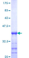 CABIN1 Protein - 12.5% SDS-PAGE Stained with Coomassie Blue.