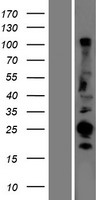 CABP / CABP1 Protein - Western validation with an anti-DDK antibody * L: Control HEK293 lysate R: Over-expression lysate