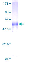 CABP / CABP1 Protein - 12.5% SDS-PAGE of human CABP1 stained with Coomassie Blue