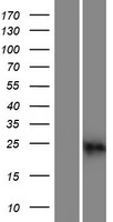 CABP2 Protein - Western validation with an anti-DDK antibody * L: Control HEK293 lysate R: Over-expression lysate