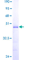 CABP4 Protein - 12.5% SDS-PAGE of human CABP4 stained with Coomassie Blue