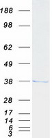 CABP4 Protein - Purified recombinant protein CABP4 was analyzed by SDS-PAGE gel and Coomassie Blue Staining