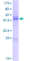 CABP7 Protein - 12.5% SDS-PAGE of human CABP7 stained with Coomassie Blue