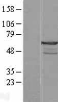CABS1 Protein - Western validation with an anti-DDK antibody * L: Control HEK293 lysate R: Over-expression lysate
