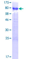 CABS1 Protein - 12.5% SDS-PAGE of human C4orf35 stained with Coomassie Blue