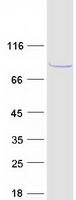 CABS1 Protein - Purified recombinant protein CABS1 was analyzed by SDS-PAGE gel and Coomassie Blue Staining